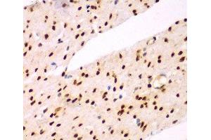 Immunohistochemistry of paraffin-embedded Human colon using TEAD3 Polyclonal Antibody at dilution of 1:100 (40x lens). (TEAD3 antibody)