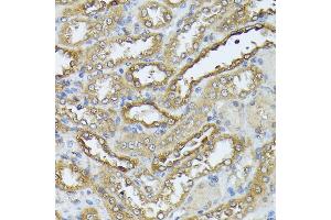 Immunohistochemistry of paraffin-embedded rat kidney using D antibody (ABIN7266712) at dilution of 1:100 (40x lens). (DAPK3 antibody  (AA 1-100))
