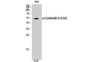 Western Blotting (WB) image for anti-Keratin 8 (KRT8) (pSer432) antibody (ABIN3182795) (KRT8 antibody  (pSer432))