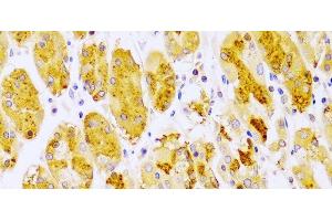 Immunohistochemistry of paraffin-embedded Human stomach using PRKCE Polyclonal Antibody at dilution of 1:100 (40x lens). (PKC epsilon antibody)