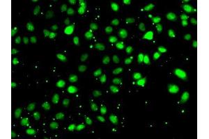 Immunofluorescence analysis of HeLa cells using NUDT2 antibody. (NUDT2 antibody  (AA 1-147))