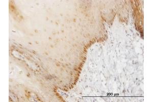 Immunoperoxidase of monoclonal antibody to HOXB7 on formalin-fixed paraffin-embedded human esophagus. (HOXB7 antibody  (AA 55-120))