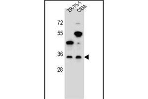 GB Antibody (N-term) (ABIN655821 and ABIN2845245) western blot analysis in ZR-75-1,CEM cell line lysates (35 μg/lane). (GPM6B antibody  (N-Term))