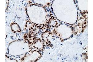 Image no. 19 for anti-EPM2A (Laforin) Interacting Protein 1 (EPM2AIP1) antibody (ABIN1498047) (EPM2AIP1 antibody)