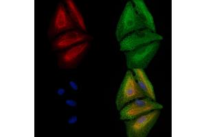 ABIN6257589 and ABIN6273720 staining  cells by IF/ICC.