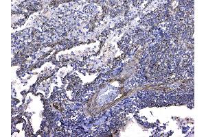 IHC analysis of GSTM3 using anti-GSTM3 antibody . (GSTM3 antibody  (AA 93-206))