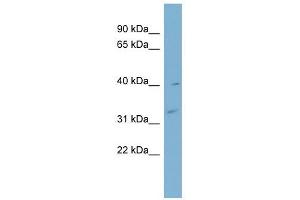 Myozenin 1 antibody used at 1 ug/ml to detect target protein. (Myozenin 1 antibody  (Middle Region))