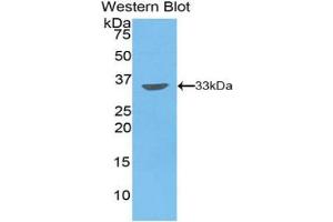 Western blot analysis of the recombinant protein. (PIM2 antibody  (AA 34-292))