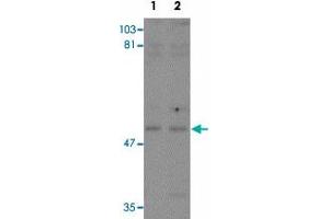 Western blot analysis of KPNA3 in EL4 cell lysate with KPNA3 polyclonal antibody  at (1) 1 and (2) 2 ug/mL.