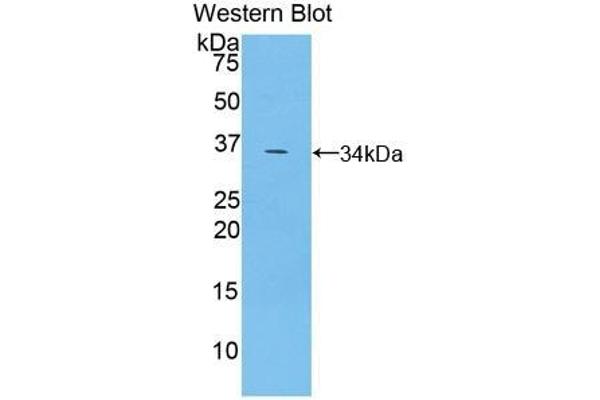 TRAF5 anticorps  (AA 181-437)