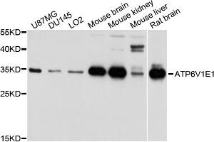 Western blot analysis of extracts of various cell lines, using ATP6V1E1 antibody.