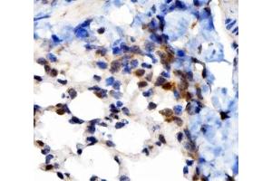 IHC analysis of VAPB using anti-VAPB antibody (ABIN5693292). (VAPB antibody  (AA 2-55))