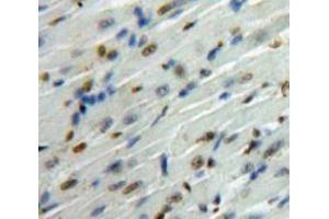 #VALUE! (SMAD6 antibody  (AA 261-495))