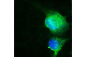 Human Melanoma cell line C 32 was cultured overnight on round cover slides placed in a 24 well tissue culture plate.