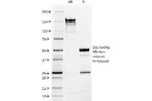 SDS-PAGE (SDS) image for anti-Epithelial Cell Adhesion Molecule (EPCAM) (AA 280-350), (Cytoplasmic Domain) antibody (ABIN6939974)