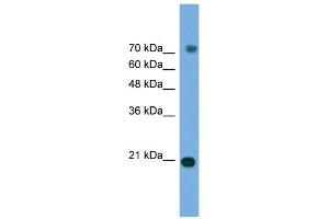 WB Suggested Anti-MAPK6 Antibody Titration: 0. (MAPK6 antibody  (Middle Region))