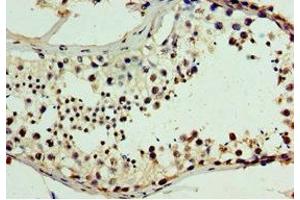 Immunohistochemistry of paraffin-embedded human testis tissue using ABIN7147719 at dilution of 1:100 (CHD2 antibody  (AA 1569-1828))