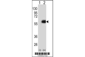Western blot analysis of NMT2 using rabbit polyclonal NMT2 Antibody (E31) using 293 cell lysates (2 ug/lane) either nontransfected (Lane 1) or transiently transfected (Lane 2) with the NMT2 gene.