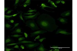 Immunofluorescence (IF) image for anti-Myotubularin Related Protein 3 (MTMR3) (AA 579-674) antibody (ABIN522387)