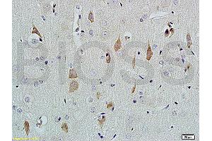 Formalin-fixed and paraffin embedded rat brain tissue labeled with Rabbit Anti-NGF-beta Polyclonal Antibody (ABIN724430) at 1:200 followed by conjugation to the secondary antibody and DAB staining.