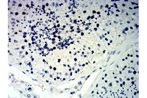 Immunohistochemistry (IHC) image for anti-Cyclin-Dependent Kinase Inhibitor 1C (p57, Kip2) (CDKN1C) antibody (ABIN7193626)