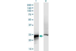 Western Blot analysis of CRYBB2 expression in transfected 293T cell line by CRYBB2 monoclonal antibody (M02), clone 1F1.