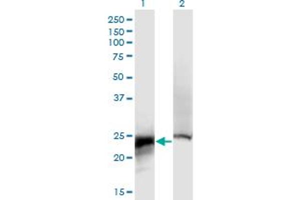 CRYbB2 anticorps  (AA 1-205)