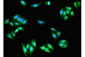 Immunofluorescent analysis of HepG2 cells using ABIN7143550 at dilution of 1:100 and Alexa Fluor 488-congugated AffiniPure Goat Anti-Rabbit IgG(H+L) (Scinderin antibody  (AA 556-703))