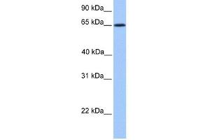 WB Suggested Anti-ZNF837 Antibody Titration:  0.