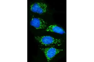 IF analysis of Pyrin/MEFV using anti-Pyrin/MEFV antibody (ABIN7601809).