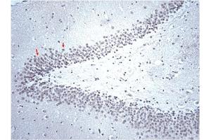 Immunohistochemistry (IHC) image for anti-Serotonin Receptor 2B (HTR2B) (AA 1-58) antibody (ABIN967504) (Serotonin Receptor 2B antibody  (AA 1-58))