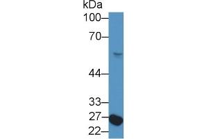 Detection of NFIX in Rat Serum using Polyclonal Antibody to Nuclear Factor I/X (NFIX) (NFIX antibody  (AA 13-298))