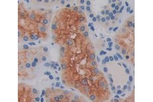 Used in DAB staining on fromalin fixed paraffin- embedded Kidney tissue (SLFN5 antibody  (AA 658-891))