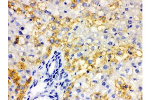 Anti- ALDH2 Picoband antibody, IHC(P) IHC(P): Rat Liver Tissue (ALDH2 antibody  (N-Term))