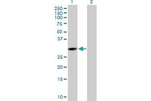 Western Blot analysis of CMBL expression in transfected 293T cell line by CMBL MaxPab polyclonal antibody.
