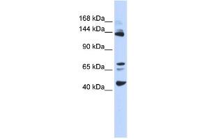 WB Suggested Anti-BRD8 Antibody Titration:  0. (BRD8 antibody  (Middle Region))