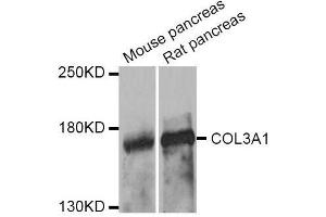 Western blot analysis of extracts of various cell lines, using COL3A1 antibody.