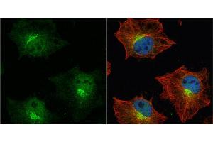 Immunofluorescence (IF) image for anti-Amyloid beta (A4) Precursor Protein (APP) (C-Term) antibody (ABIN2855011)