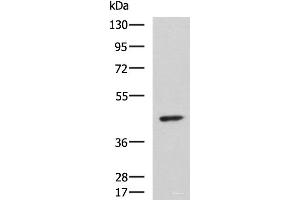 Western blot analysis of Hela cell lysate using ARPC1B Polyclonal Antibody at dilution of 1:1000 (ARPC1B antibody)