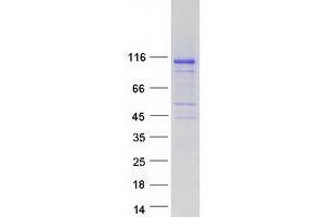 Validation with Western Blot