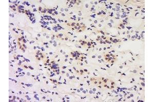 Formalin-fixed and paraffin embedded human kidney labeled with Anti-Calcipressin 1/DSCR 1 Polyclonal Antibody, Unconjugated  at 1:200 followed by conjugation to the secondary antibody and DAB staining. (RCAN1 antibody  (AA 101-200))