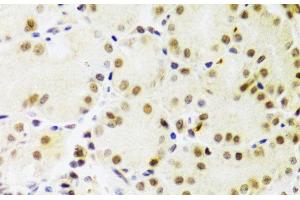 Immunohistochemistry of paraffin-embedded Human stomach using PRPF3 Polyclonal Antibody at dilution of 1:100 (40x lens). (PRPF3 antibody)
