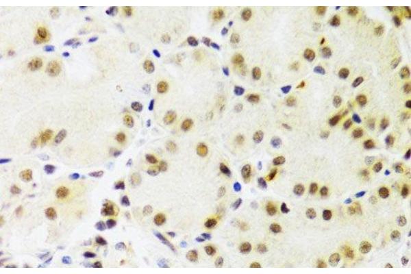 PRPF3 antibody
