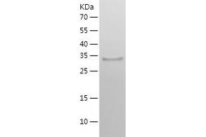 Western Blotting (WB) image for Starch Binding Domain 1 (STBD1) (AA 24-358) protein (His tag) (ABIN7125209) (STBD1 Protein (AA 24-358) (His tag))