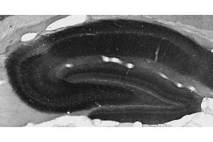 Adult rat hippocampal immunohistochemistry. (KCNT2 antibody  (AA 564-624))