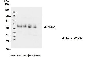 Immunoprecipitation (IP) image for anti-B-cell antigen receptor complex-associated protein alpha chain (CD79A) (AA 33-143) antibody (ABIN7453962) (Recombinant CD79a antibody  (AA 33-143))