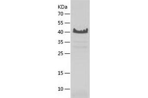Western Blotting (WB) image for Nascent Polypeptide Associated Complex alpha 1 (NACa1) (AA 1-215) protein (His tag) (ABIN7124113) (NACA Protein (AA 1-215) (His tag))