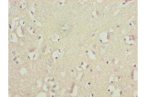 Immunohistochemistry of paraffin-embedded human brain tissue using ABIN7145497 at dilution of 1:100 (GLB1L2 antibody  (AA 401-636))