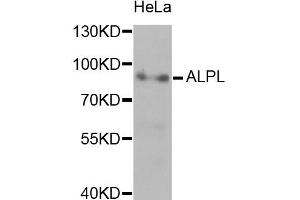 Western blot analysis of extracts of HeLa cells, using ALPL antibody (ABIN5970438) at 1/1000 dilution. (ALPL antibody)