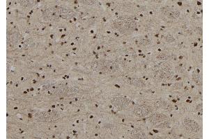 ABIN6267208 at 1/100 staining Rat brain tissue by IHC-P. (MECP2 antibody  (pSer80))